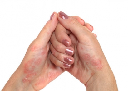 Számítógépes kezelés különböző bőrbetegségek ellen