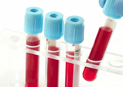 Élő vércsepp analízis + candida teszt